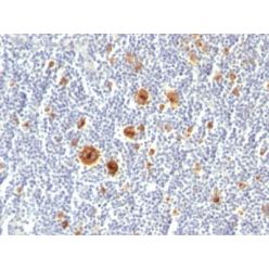 CD30(Ki-1/779), CF640R conjugate, 0.1mg/mL