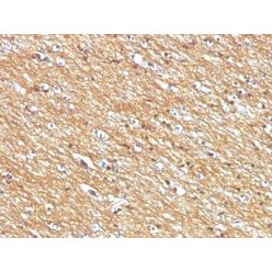 CD56 / NCAM(NCAM1/795), CF640R conjugate, 0.1mg/mL