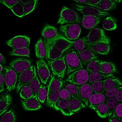 Cytokeratin 19(KRT19/799), CF640R conjugate, 0.1mg/mL