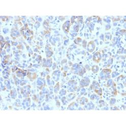 TYRP1 (Tyrosinase Related Protein 1)(TA99), CF640R conjugate, 0.1mg/mL