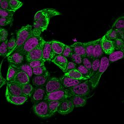 Cytokeratin 18(KRT18/834), CF640R conjugate, 0.1mg/mL