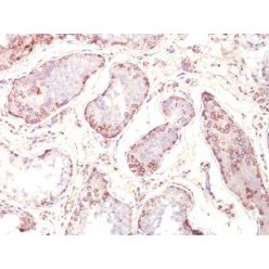 MAGE A1(MZ2E/838), CF640R conjugate, 0.1mg/mL
