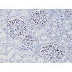 WT1 (Wilm's Tumor 1)(WT1/857), CF640R conjugate, 0.1mg/mL