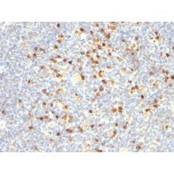 Human Lambda Light Chain(Lamb14), CF640R conjugate, 0.1mg/mL