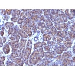 Nuclear Membrane(AE-5), CF640R conjugate, 0.1mg/mL