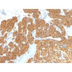 PTH / Parathyroid Hormone (N-Terminal)(PTH/911), CF640R conjugate, 0.1mg/mL