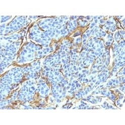 NGFR (Nerve Growth Factor Receptor)(NTR/912), CF640R conjugate, 0.1mg/mL