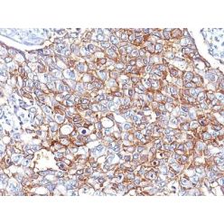 Ep-CAM / CD326(EGP40/826 + EGP40/837 + EGP40/1110 + EGP40/1120), CF640R conjugate, 0.1mg/mL