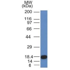 CD117(KIT/982), CF640R conjugate, 0.1mg/mL