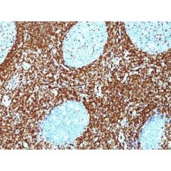 bcl-2(BCL2/782 + BCL2/796), CF640R conjugate, 0.1mg/mL