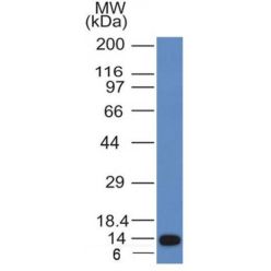 Biotium BNC401031-100, ALK (Anaplastic Lymphoma Kinase) / CD246(ALK/1031), CF640R conjugate, 0.1mg/mL