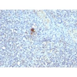 TRAcP (Tartarate Resistant Acid Phosphatase)(ACP5/1070), CF640R conjugate, 0.1mg/mL