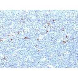 HLA-Aw32 & HLA-A25 (MHC I)(CATA-1), CF640R conjugate, 0.1mg/mL