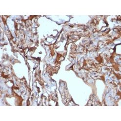 MUC18 / Mucin 18 / CD146(MUC18/1130), CF640R conjugate, 0.1mg/mL