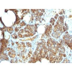 PTH / Parathyroid Hormone (N-Terminal)(PTH/1173), CF640R conjugate, 0.1mg/mL