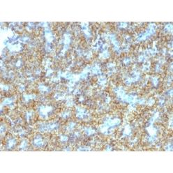 PTH / Parathyroid Hormone (N-Terminal)(PTH/1174), CF640R conjugate, 0.1mg/mL