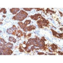 PTH / Parathyroid Hormone (N-Terminal)(PTH/1175), CF640R conjugate, 0.1mg/mL