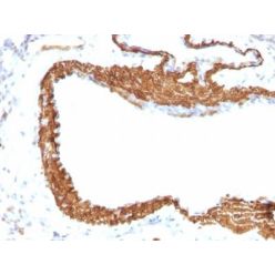Smooth Muscle Actin(ACTA2/791 +1A4), CF640R conjugate, 0.1mg/mL
