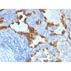 Cytokeratin 8/18(B22.1 + B23.1), CF640R conjugate, 0.1mg/mL