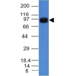 UACA / Nucling(UACA/1222), CF640R conjugate, 0.1mg/mL