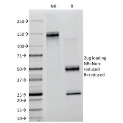 Creatine Kinase-BB (CK-BB) (CKBB/1268), CF640R conjugate, 0.1mg/mL