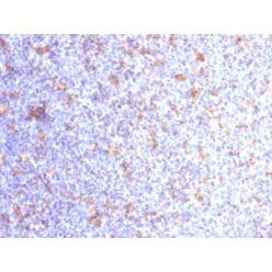 VEGI (Vascular Endothelial Growth Inhibitor) (VEGI/1283), CF640R conjugate, 0.1mg/mL