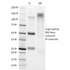 Helicobacter pylori(HP/1336), CF640R conjugate, 0.1mg/mL