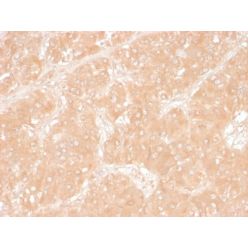 Adipophilin / Perilipin-2 (Marker of Obesity) (ADFP/1366), CF640R conjugate, 0.1mg/mL