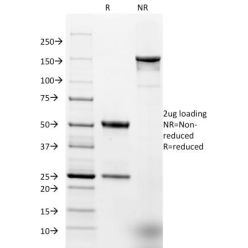 Ep-CAM / CD326 (Extracellular Domain) (Epithelial Marker) (EGP40/1384), CF640R conjugate, 0.1mg/mL