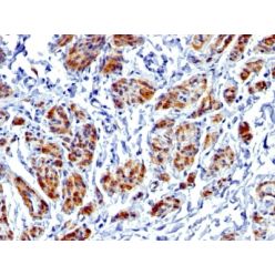 Caldesmon, HMW (h-Caldesmon) (Smooth Muscle Marker) (CALD1/1424R), CF640R conjugate, 0.1mg/mL