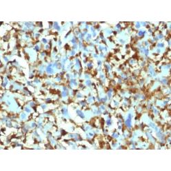 Factor XIIIa (Coagulation Factor XIIIA Chain) (F13A1/1448), CF640R conjugate, 0.1mg/mL