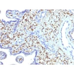 S100A4 (Marker of Tumor Metastasis) (S100A4/1481), CF640R conjugate, 0.1mg/mL