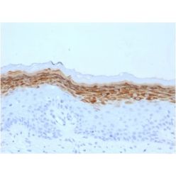 Filaggrin (Keratinocyte Differentiation Marker) (FLG/1561), CF640R conjugate, 0.1mg/mL