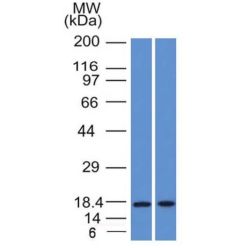 GCDFP-15 (Gross Cystic Disease Fluid Protein 15) (Breast Marker) (PIP/1571), CF640R conjugate, 0.1mg/mL