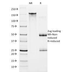 HIF1 alpha (Hypoxia-Inducible Factor 1-alpha)(ESEE122), CF640R conjugate, 0.1mg/mL