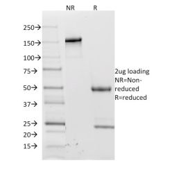 CD62L (L-Selectin)(CD62L/1588), CF640R conjugate, 0.1mg/mL