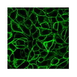 Endoglin / CD105 (ENG/1621), CF640R conjugate, 0.1mg/mL