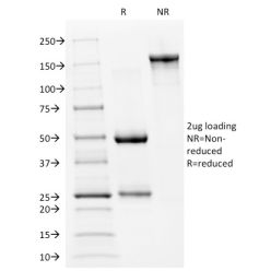 p53 Tumor Suppressor Protein(PAb240), CF640R conjugate, 0.1mg/mL