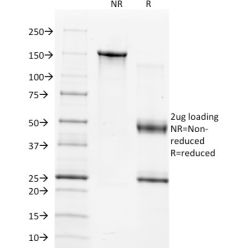 TIMP1 (Marker of Lymph Node Metastasis)(2A5), CF640R conjugate, 0.1mg/mL