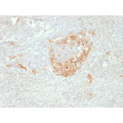 NSE gamma (Neuron Specific Enolase, gamma) (Neuroendocrine Marker)(NSE-P2), CF640R conjugate, 0.1mg/mL