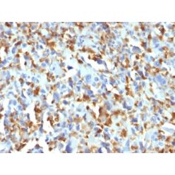 Factor XIIIa (Coagulation Factor XIIIA Chain) (F13A1/1683), CF640R conjugate, 0.1mg/mL
