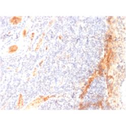 VEGF (Vascular Endothelial Growth Factor)(VG1), CF640R conjugate, 0.1mg/mL