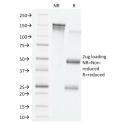 VEGF (Vascular Endothelial Growth Factor)(VG76e), CF640R conjugate, 0.1mg/mL