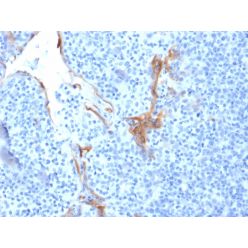 Cytokeratin 16 (KRT16) (Suprabasal Keratinocyte Marker)(LL025), CF640R conjugate, 0.1mg/mL