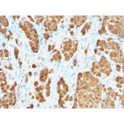 S100B (Astrocyte and Melanoma Marker) (S100B/1706R), CF640R conjugate, 0.1mg/mL