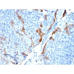 Cytokeratin 16 (KRT16) (Suprabasal Keratinocyte Marker)(KRT16/1714), CF640R conjugate, 0.1mg/mL