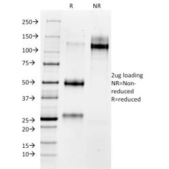 MMP3 (Marker of Metastasis and Rheumatoid Arthritis)(1B4), CF640R conjugate, 0.1mg/mL