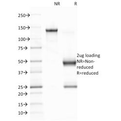 Epstein-Barr Virus (LMP-1)(CS1), CF640R conjugate, 0.1mg/mL