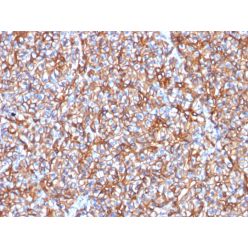 Spectrin beta III (SPTBN2) (SPTBN2/1778), CF640R conjugate, 0.1mg/mL