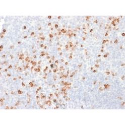 SOX2 (Transcription Factor) (SOX2/1791), CF640R conjugate, 0.1mg/mL